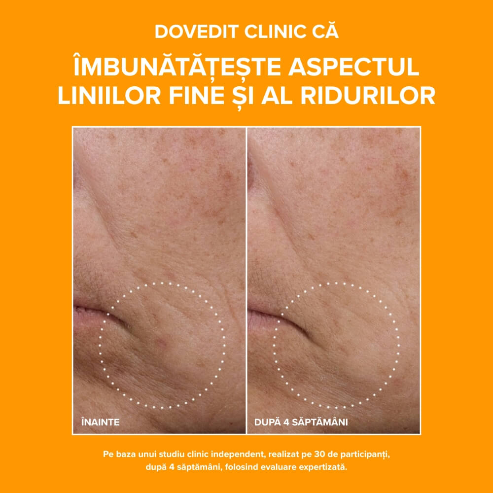 C15 Super Booster before/after