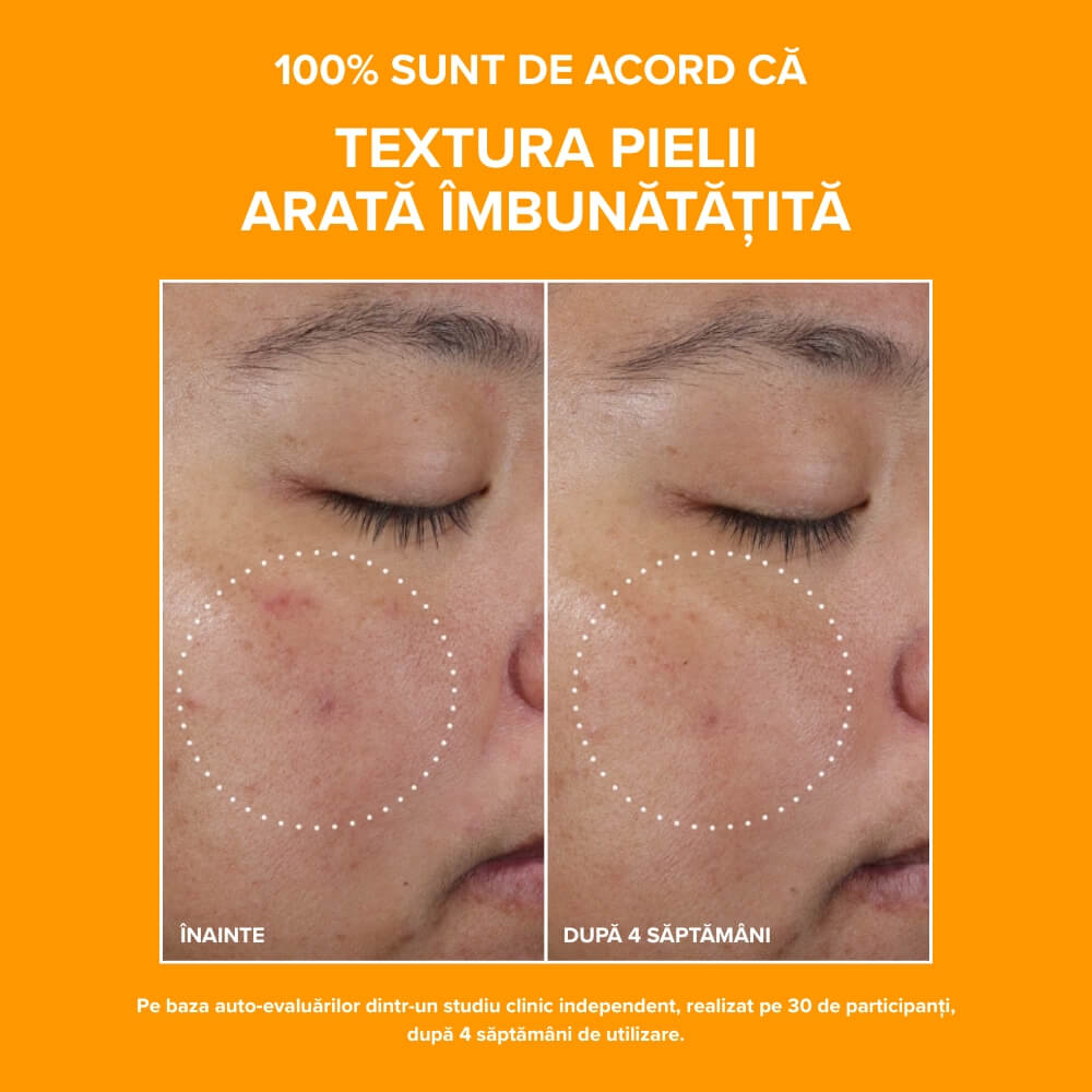 C15 Super Booster before/after