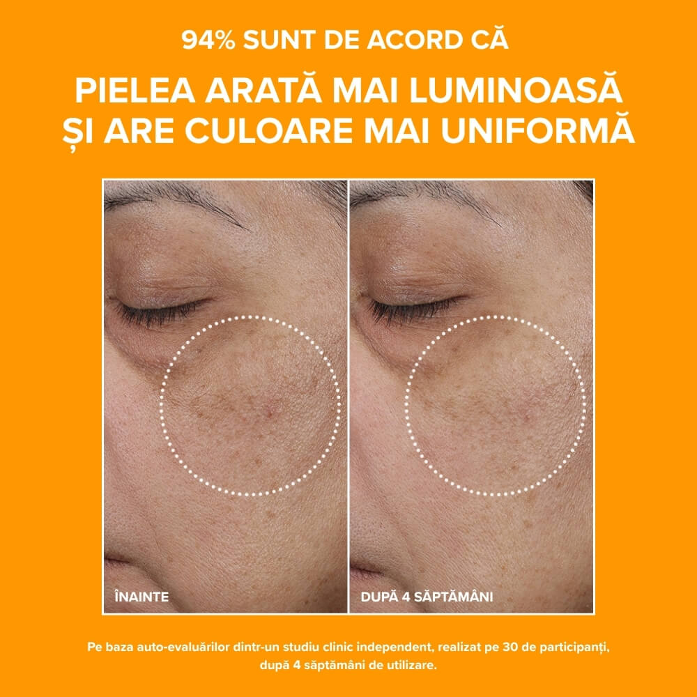 C15 Super Booster before/after